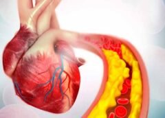 Triglicéridos altos: síntomas, causas y cómo reducirlos eficazmente